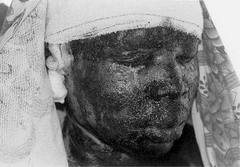 A felismerhetetlens&eacute;gig &ouml;ssze&eacute;gett Mamour Gama Mamour